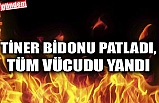 TİNER BİDONU PATLADI, TÜM VÜCUDU YANDI