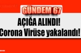 AÇIĞA ALINDI!  Corona Virüse yakalandı!