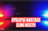 EPİLEPSİ HASTASI ELİNİ KESTİ!