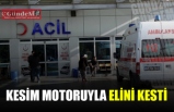 Kesim motoruyla elini kesti!