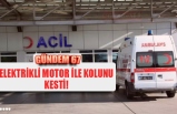 KOLUNU KESTİ!