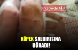 KÖPEK SALDIRISINA UĞRADI!