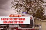 ODUN KESME MOTORUNA  BACAĞINI KAPTIRDI!