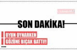 Oyun oynarken gözüne bıçak battı