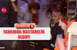 YANGINDA HASTANELİK OLDU!