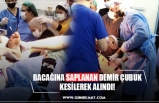 BACAĞINA SAPLANAN DEMİR ÇUBUK KESİLEREK ALINDI!