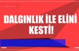 DALGINLIK İLE ELİNİ  KESTİ!