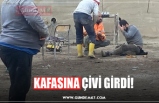 KAFASINA ÇİVİ GİRDİ!