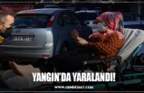 YANGIN’DA YARALANDI!