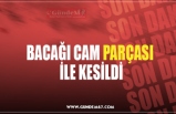 BACAĞI CAM PARÇASI  İLE KESİLDİ