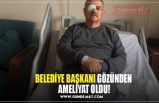 BELEDİYE BAŞKANI GÖZÜNDEN  AMELİYAT OLDU!