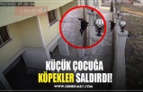 KÜÇÜK ÇOCUĞA  KÖPEKLER SALDIRDI!