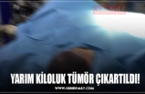 YARIM KİLOLUK TÜMÖR ÇIKARTILDI!